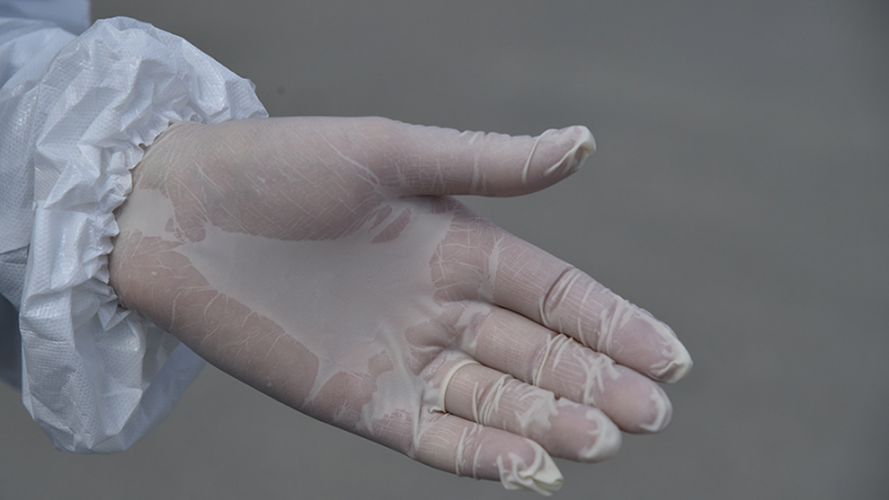 В Москве возбудили дело после поставок почти 10 млн использованных перчаток