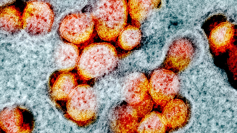 Во Франции нашли плохо поддающийся выявлению штамм коронавируса