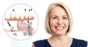 Здоровье улыбки: Комплексный подход к лечению и восстановлению зубов